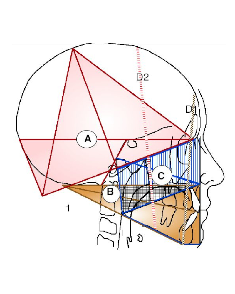 Orthodontie Le Vésinet